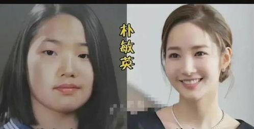 韩国整形前后对比明星,明星整形前后对比大揭秘