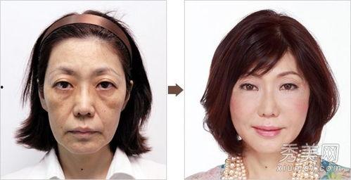 日本大阪整容,揭秘日本整形艺术的魅力